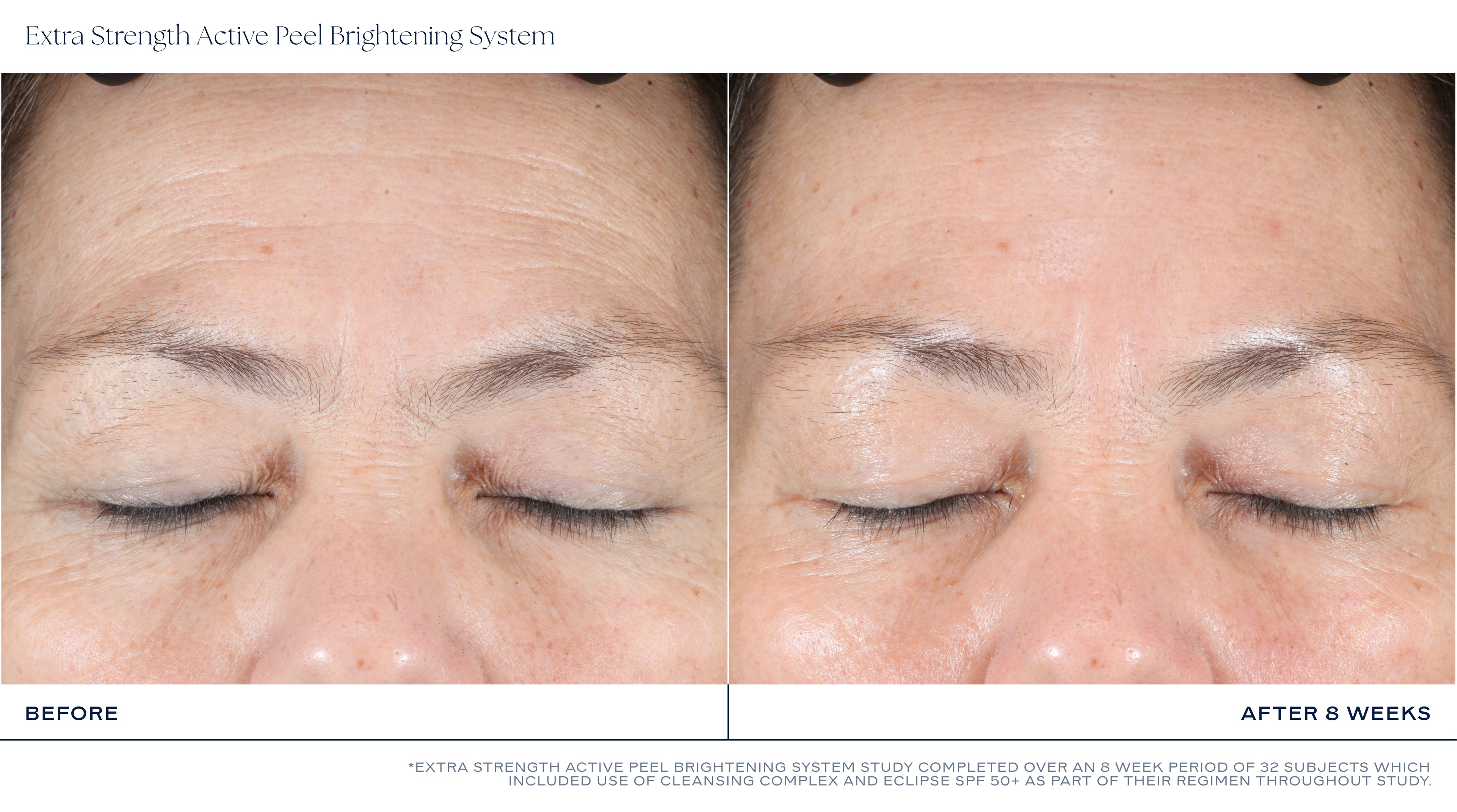 Extra Strength Active Peel Brightening System